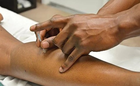 针灸科年终工作总结